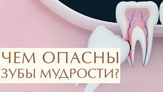 🤔 Для чего нужны зубы мудрости, стоит или нет их удалять. Удалять или нет зуб мудрости. 12+