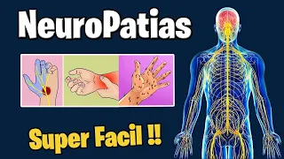 Neuropatias | Sintomas diagnostico y tratamiento | Neuropatia periferica