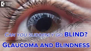 Glaucoma Treatment | Glaucoma Types | Glaucoma and Blindness - Dr . Sirish Nelivigi