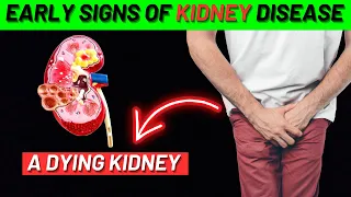 14 Early Warning Signs of KIDNEY DISEASE to Never Ignore