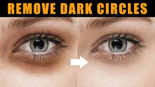How to Remove Dark Circles in Photoshop Tutorial | One Minute Photoshop #Shorts