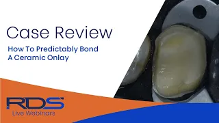 How to predictably bond a ceramic onlay