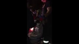 Firework explodes in teen's hand