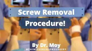 SCREW REMOVAL PROCEDURE!! (quick, easy, & painless)  #footsurgery #footpain #bunions #bunionsurgery