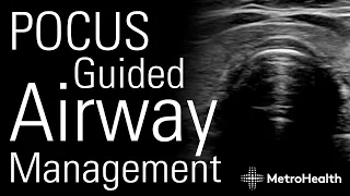 POCUS Guided Airway Management