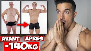 IL PERD 140 KILOS ET SA PEAU PEND !