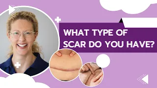 Are you wondering which type of C-section scar you have? - HLP Therapy