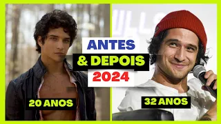 Confira o Antes e depois Teen Wolf 2011 - 2024| Elenco do lobo adolescente