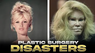 The Dark Side of Hollywood | Top 10 Plastic Surgery Disasters Exposed!