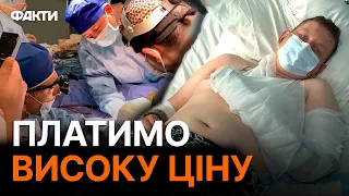 АМПУТАЦІЇ, МІННО-ВИБУХОВІ та КУЛЬОВІ поранення: ДОРОГА ЦІНА за звільнення України