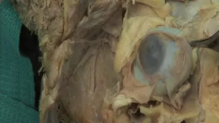 1.10 Step 6. Internal structures of the eye