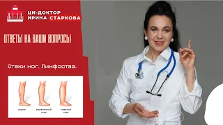 Отеки ног. Лимфостаз. Что можно сделать ?