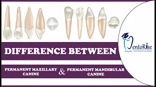 Difference between Permanent Maxillary & Mandibular Canine|LINK IN DESCRIPTION|Dental Anatomy#shorts