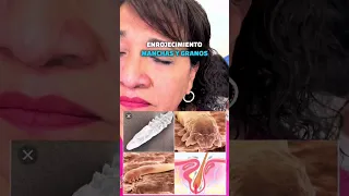 😱Truco para eliminar parásitos en la piel ácaros tipo demodex en cara ya lo sabías ? 🤨