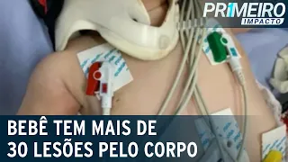 Médica aciona polícia após examinar bebê com 30 lesões no corpo | Primeiro Impacto (12/05/21)