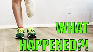 WHAT HAPPENED?! My Story of How I Lost My Leg and Became an Amputee