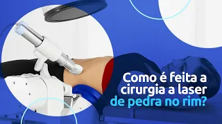 Como é feita a cirurgia a laser de pedra no rim?