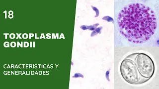 Toxoplasma Gondii  18 || Toxoplasmosis || Apicomplexas || Parásitos