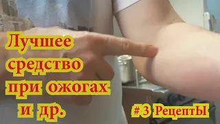 Самое лучшее средство при ОЖОГАХ и др  # 3 РецептЫ