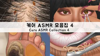 ASMR CARE ANIMATION COLLECTION 4 | Head Lice, Calluses, Corn Treatment, Dry Eyelid Sebum Extrusion