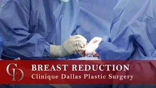 Breast Reduction - Clinique Dallas Plastic Surgery