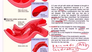 Sickle Cell Disease