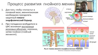 По полочкам  "Менингококковая инфекция"