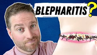 What Is Blepharitis? (Blepharitis Explained - Best Treatments)
