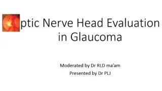 Optic Nerve Head Eveluation in Glaucoma by  Dr. Rathini Liliam David, 08 Aug, 2017