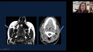 Imaging of the parotid gland Part 1 | Health4TheWorld Academy