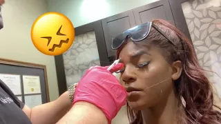 GETTING BOTOX FOR THE FIRST TIME! *insane*