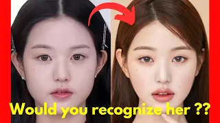 IVE Wonyoung plastic surgery.. Just WHY?!