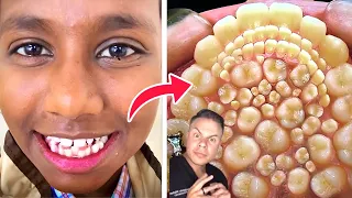 This Girl Has 100 Teeth?!