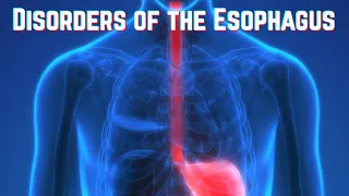 Disorders of the Esophagus (updated 2023) - CRASH! Medical Review Series