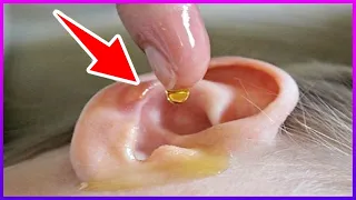 Veja Como Curar Uma Infecção no Ouvido Naturalmente !