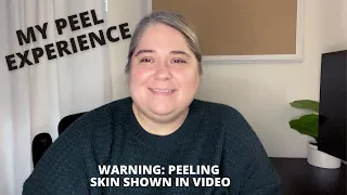 What It’s Like To Get A Chemical Peel | VI Peel Precision Plus | Peel for Pigmentation