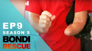 Shark Attack Survivor Reveals Aftermath! | Bondi Rescue - Season 5 Episode 9 (OFFICIAL UPLOAD)