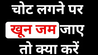 चोट लगने पर blood जम जाए तो क्या करे ? | खून का थक्का जम जाये तो क्या करे ? | Jyoti Tips