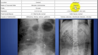 radiology cases small bowel versus large bowel