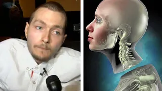 What Happened To The First Human Head Transplant? (Feat. Medlife Crisis)