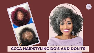 CCCA ALOPECIA HAIRSTYLES DO'S AND DON'TS (PART 1)