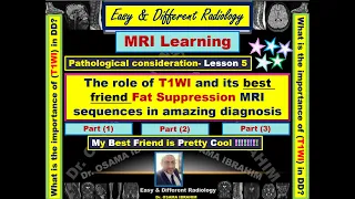 The role of T1 and its best friend fat suppression sequences in amazing diagnosis- Part (1)