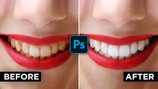 How to Whiten Teeth Naturally in Photoshop 2021 #2MinuteTutorial