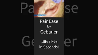 Killing Ticks Instantly with Pain Ease by Gabauer!