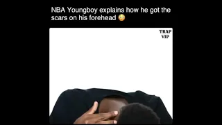NBA YoungBoy explains how he got the scars on his forehead 😳