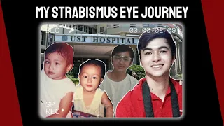 DATI AKONG DULING! PAANO NAAYOS? 😳 | Strabismus Surgery Story & Encouragement | KevInSeries