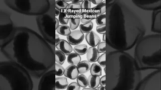 Mexican Jumping Bean X-Ray