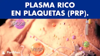 Plasma Rico en Plaquetas - Regeneración de tejidos ©