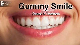 Gummy Smile | What Causes it & How is it Treated? - Dr.Ranjani Rao