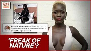 'Freak Of Nature'?: Columbia Suspends Psychiatry Head Over Tweet About Dark-Skinned Model | #RMU